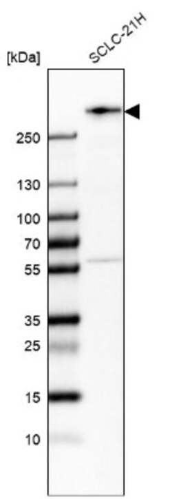 WNK2 Antibody, Novus Biologicals 0.1mL; Unlabeled:Antibodies, Polyclonal